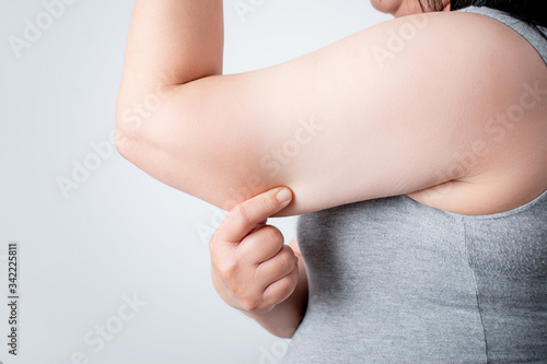 Canvas Print Excess fat under the arms of women who are overweight