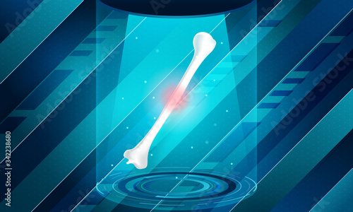 New technology for humerus bone injury. Abstract traumatology and orthopedics. Medical, science and technology, the hospital for body joints.