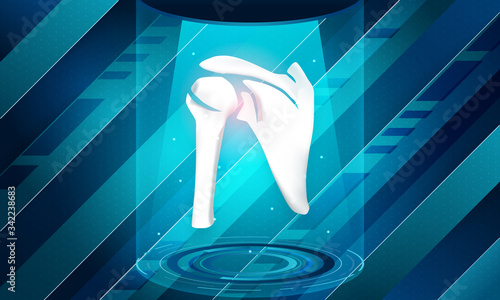 New technology for shoulder bone injury. Abstract traumatology and orthopedics. Medical, science and technology, the hospital for body joints.