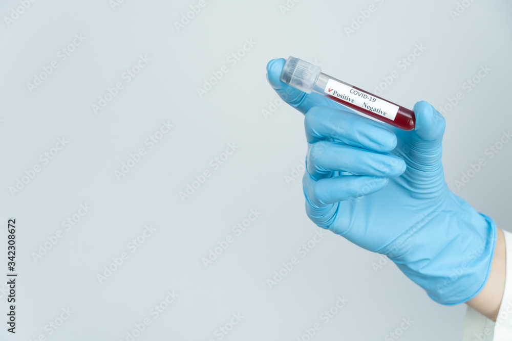 Obraz premium Woman's blue-gloved hand holds a test tube of blood with a positive result for COVID-19 with a copy space. Concept of medicine, analysis.