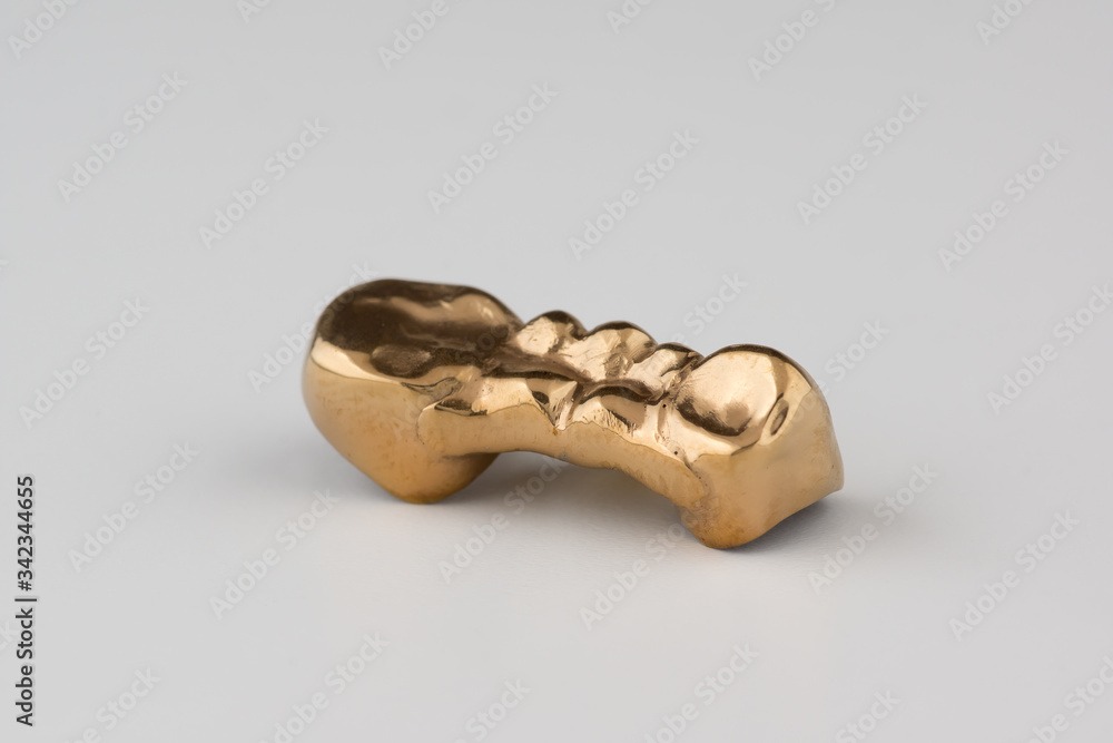 Artificial tooth crown coated gold Artificial tooth crown coated gold