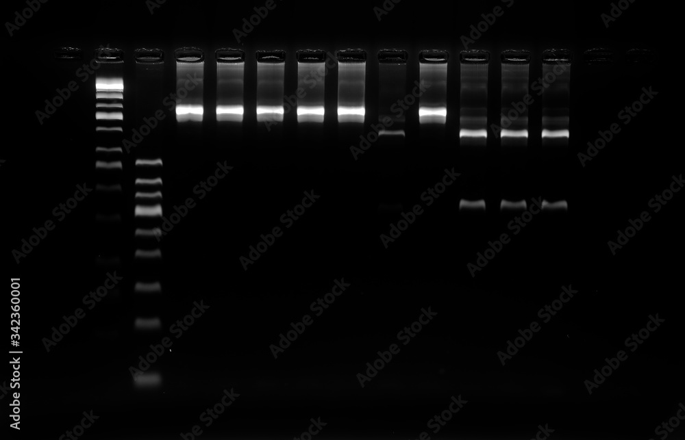 PCR band on agarose gel using  by molecular technique. Molecular analysis