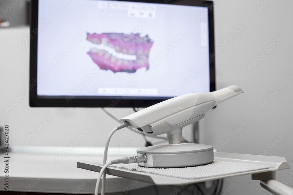 Dental 3d scanner and monitor in the dentist's office Dental 3d scanner and monitor in the dentist's office
