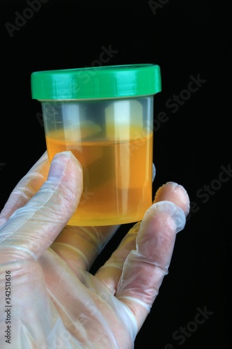 Foto Urine sample taken for toxicology testing in a medical exam