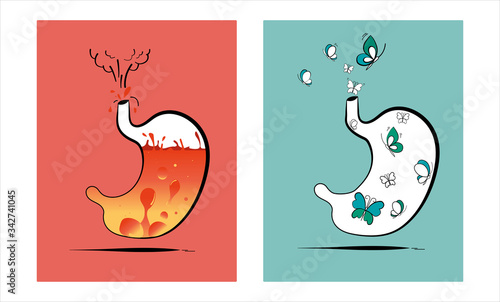 Stomach vector illustration. Concept of two different health conditions. The first shows heartburn and volcano fire. The second shows comfort in the form of flying butterflies. Medical theme.