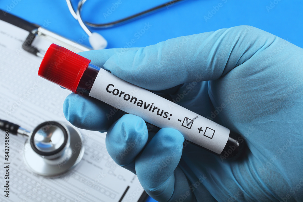 Blood test for coronavirus. Vacuum tube with blood. Blue background. Blood test for coronavirus. Vacuum tube with blood. Blue background.