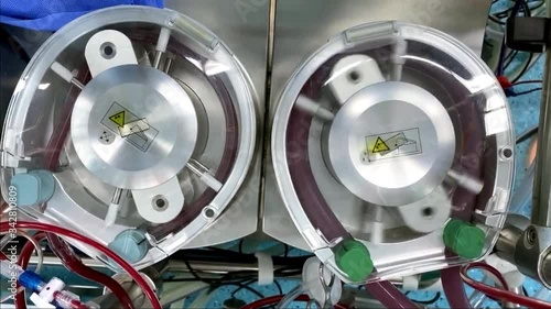 Close up heart lung machine top view on roller pump of heart lung machine during cardiac surgery surgery with blood is passing through plastic tubes Help patients who are undergoing surgery.