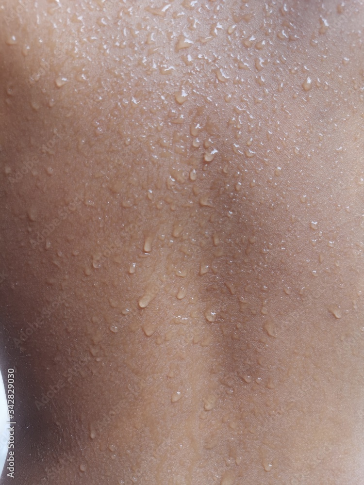 Water drops at the skin