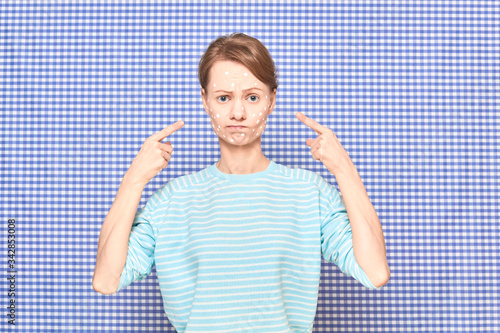 Canvastavla Portrait of unhappyl girl pointing at white spots of cosmetic on face