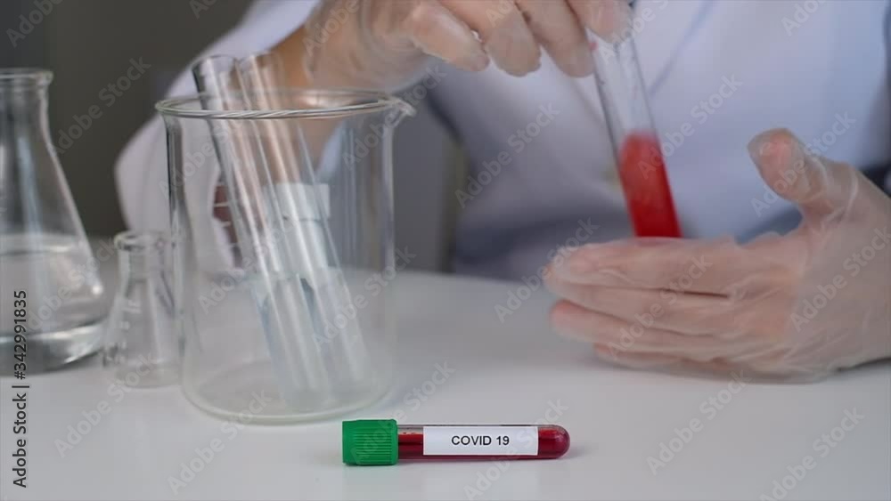 covid 19 blood test in the laboratory for medicine and vaccine research and development . clinical trial and science.