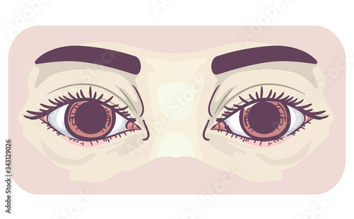 Symptom Dilated Pupils Illustration
