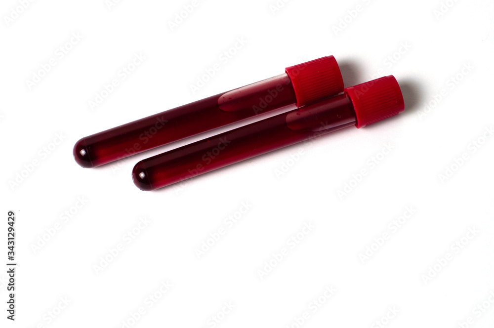 Two test tubes with blood isolate on a white background. The concept of medicine, the fight against viruses and bacteria, diseases Two test tubes with blood isolate on a white background. The concept of medicine, the fight against viruses and bacteria, diseases