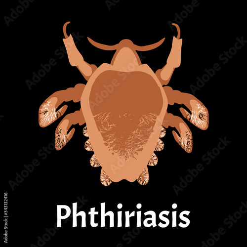 Parasitic diseases of Phthiriasis. Pediculosis pubis. Pubic lice structure. Sexually transmitted diseases. Infographics. Vector illustration on isolated background.