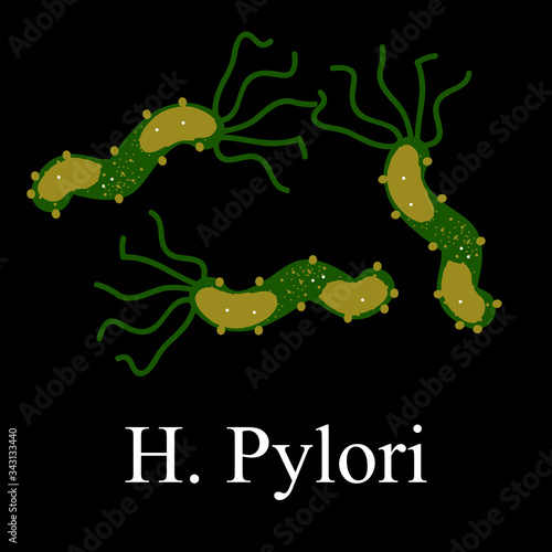 Helicobacter pylori. Helicobacter pylori of infection. Infographics. Vector illustration