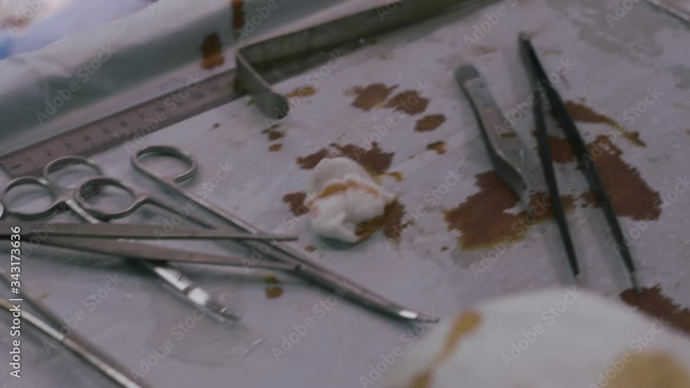 Surgical instruments and instruments in the operating room, during surgery, blood stains. Used tools after the operation. Surgical instruments and instruments in the operating room, during surgery, blood stains. Used tools after the operation.
