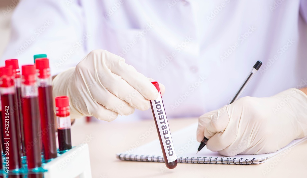 Young handsome lab assistant testing blood samples in hospital Young handsome lab assistant testing blood samples in hospital