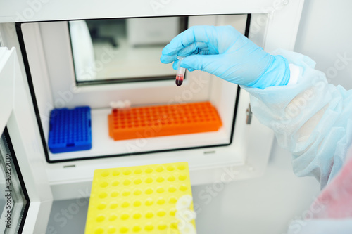 a scientist or employee of a scientific chemical and bacteriological laboratory gives a blood sample to a special laboratory window of DNA PCR. Virology  epidemic  coronavirus.