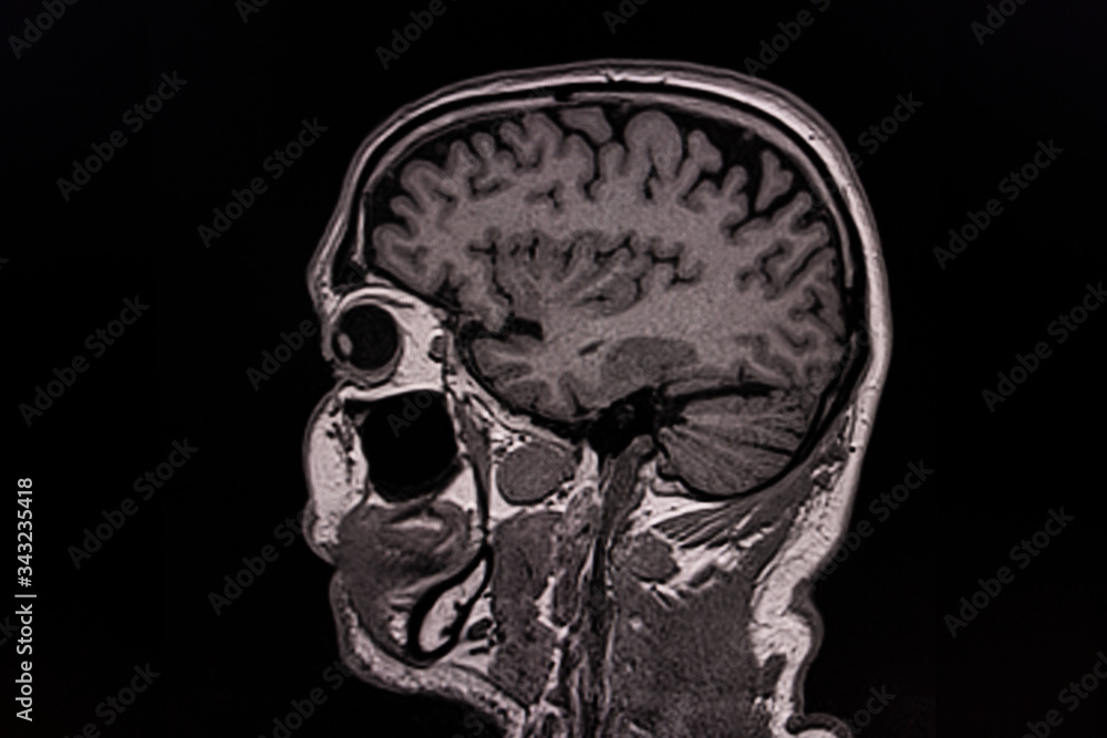 MRT images of a human head