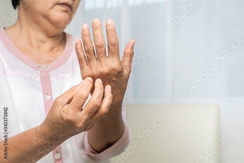 senior women scratch hand the itch on eczema arm, healthcare and medicine concept © PORNCHAI SODA