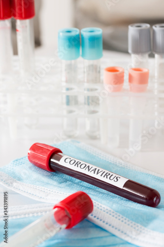 Coronavirus 2019-nCoV blood test with laboratory background 