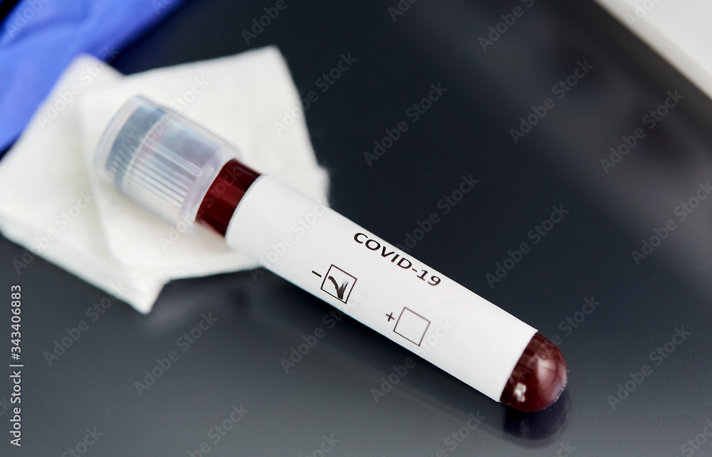 Obraz premium medicine, healthcare and pandemic concept - close up of beaker with negative coronavirus blood test on table at laboratory