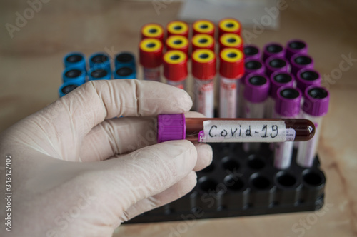 Blood testing of Corona Virus in Laboratory.