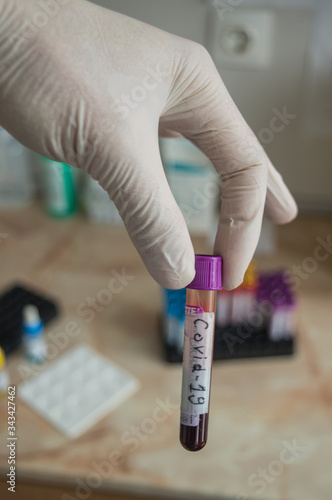 Blood testing of Corona Virus in Laboratory.