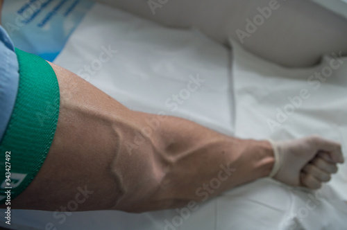 Good veins for taking blood in hospital.