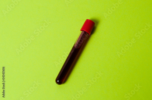 Test tube with blood isolate on a green background