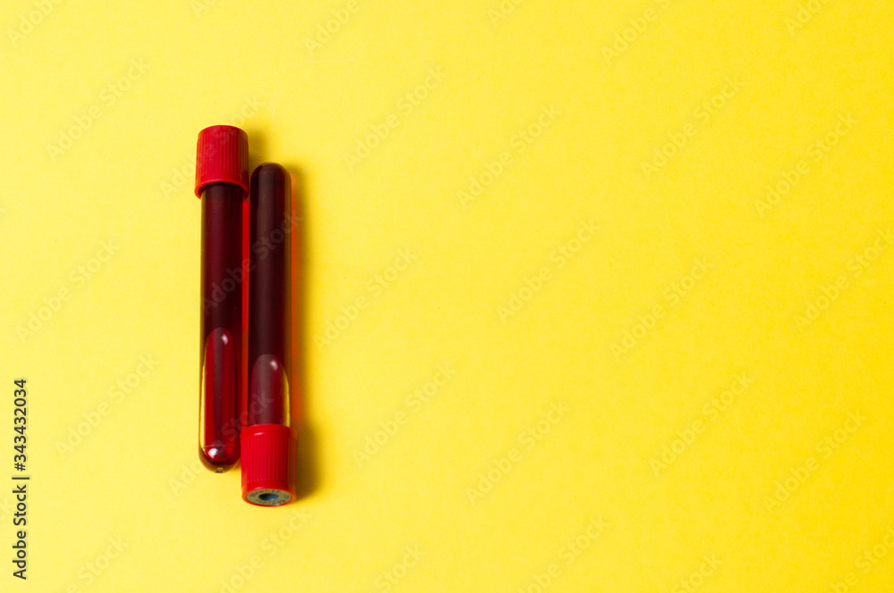 Two test tubes with blood isolate on yellow background. Concept medicine, the fight against viruses and bacteria, diseases Two test tubes with blood isolate on yellow background. Concept medicine, the fight against viruses and bacteria, diseases