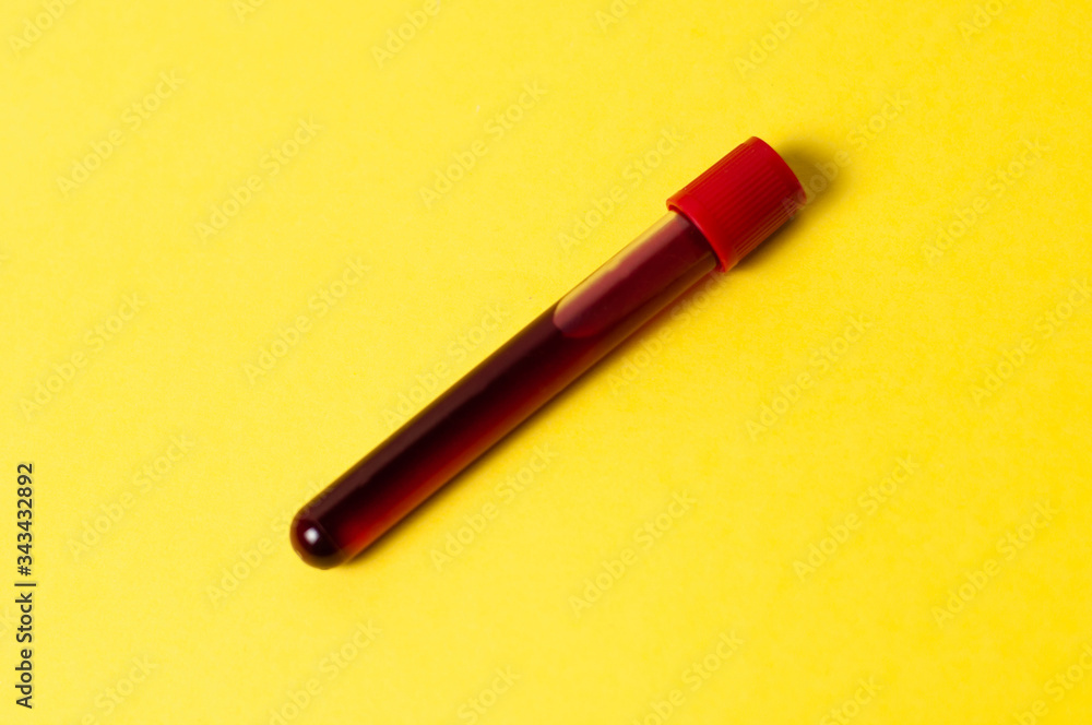 Test tube with blood isolate on a yellow background Test tube with blood isolate on a yellow background