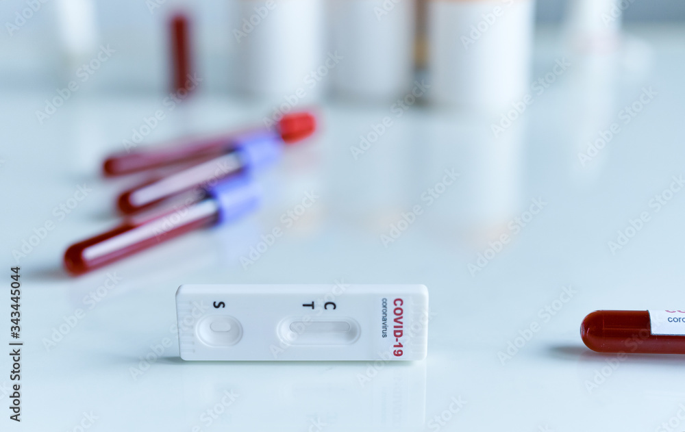 rapid or express test for COVID-19, lab card kit test for viral influenza. test tubes containing a blood sample on background. Testing for presence of coronavirus.