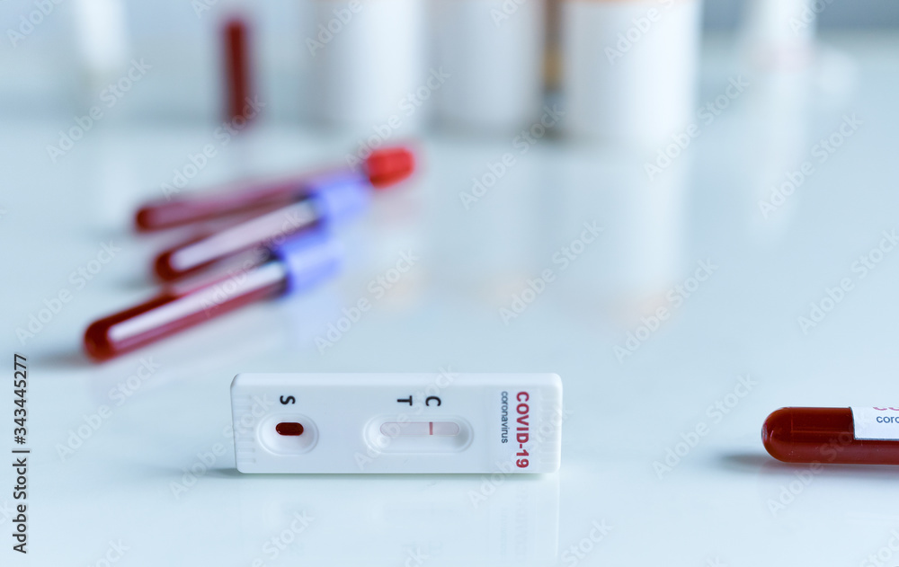 rapid or express test for COVID-19 with negative result, lab card kit test for viral influenza. test tubes containing a blood sample on background. Testing for presence of coronavirus.