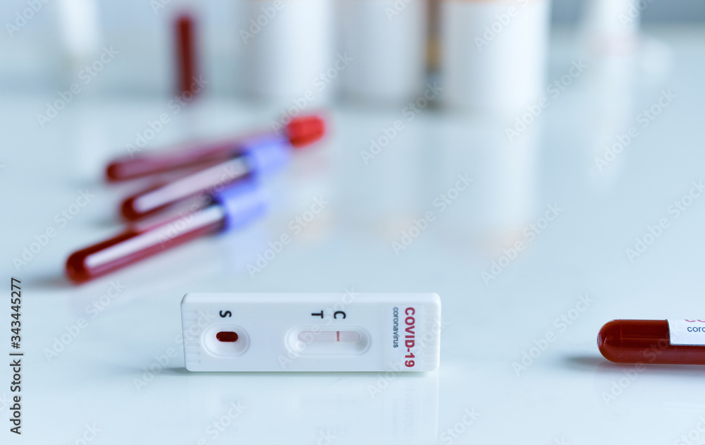 rapid or express test for COVID-19 with negative result, lab card kit test for viral influenza. test tubes containing a blood sample on background. Testing for presence of coronavirus. rapid or express test for COVID-19 with negative result, lab card kit test for viral influenza. test tubes containing a blood sample on background. Testing for presence of coronavirus.