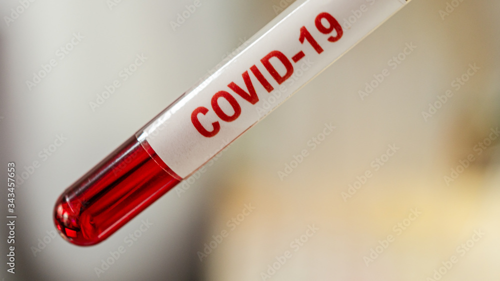 test tube, In there, the blood that was examined for the covid-19 virus . test tube, In there, the blood that was examined for the covid-19 virus .