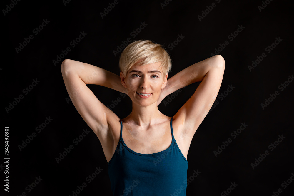 Distinctive feature. Woman with spots on body Distinctive feature. Woman with spots on body