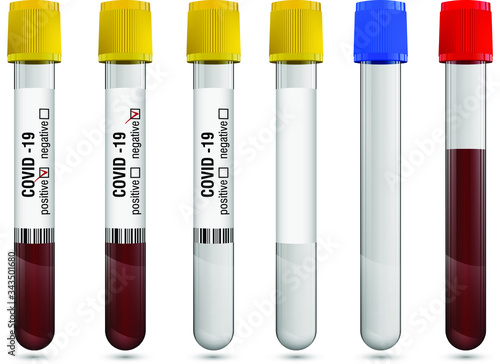 Vector transparent glass test tubes with caps and labels on white background