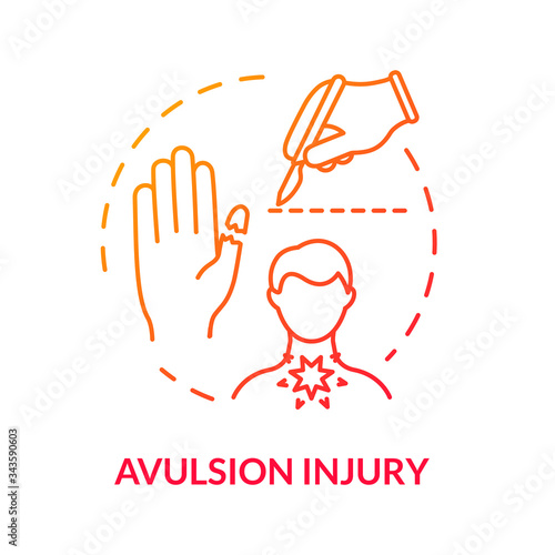 Limb avulsion, finger deprivation concept icon. Traumatism, amputation, human body harm, surgery, bone fracture idea thin line illustration. Vector isolated outline RGB color drawing.