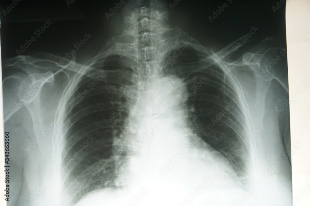 Medical concept: Image of adult x-ray film Medical concept: Image of adult x-ray film