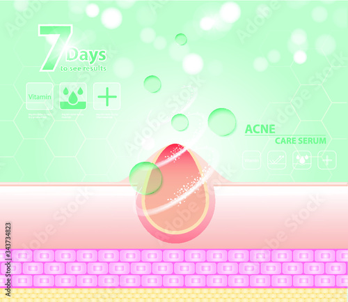 Three main layer of the human skin. skin aging stages diagrams, ollagen and elastin progressive decrease close up, skincare infographics. Illustration about medical diagram.