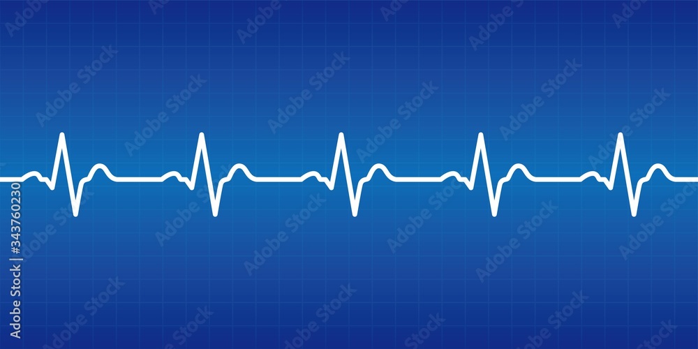 Graphic material representing an electrocardiogram