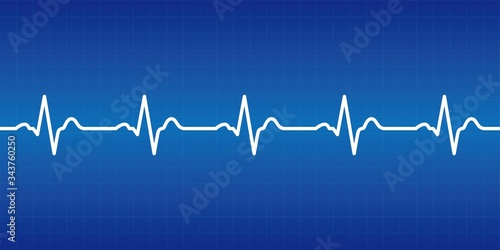 Graphic material representing an electrocardiogram