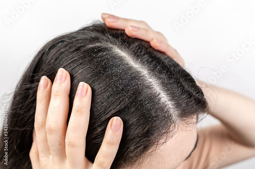 The woman holds her head with her hands, showing a parting of dark hair with dandruff. Close up. The view from the top. Zoomed parting.White background. The concept of dandruff and pediculosis photo