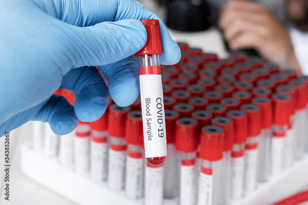 Cropped view of scientist in latex glove holding test tube with blood sample, Test tube with blood sample for COVID-19 test, novel coronavirus 2019 Cropped view of scientist in latex glove holding test tube with blood sample, Test tube with blood sample for COVID-19 test, novel coronavirus 2019