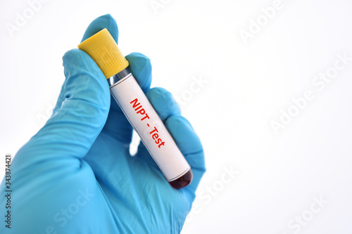 Photo Blood sample tube for NIPT test or non-invasive prenatal testing, diagnosis for