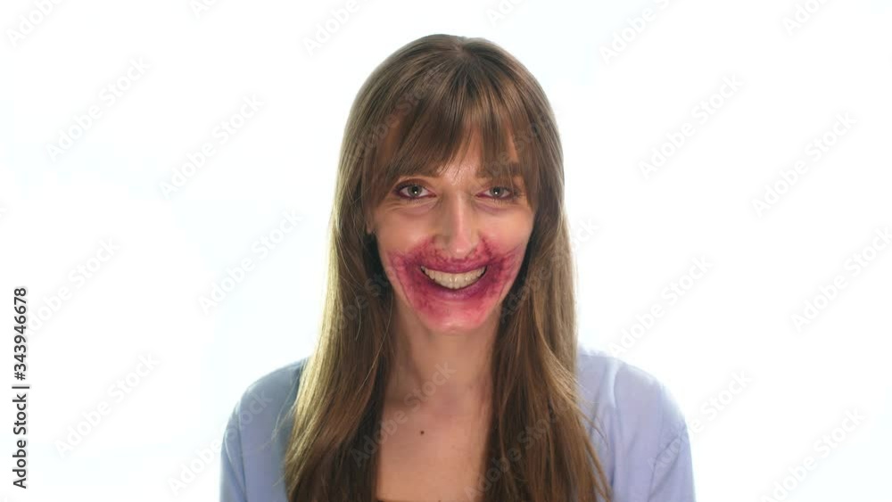 portrait of a girl on a white background looking at the camera, with a makeup disease in the form of inflammation around her mouth and smiling portrait of a girl on a white background looking at the camera, with a makeup disease in the form of inflammation around her mouth and smiling