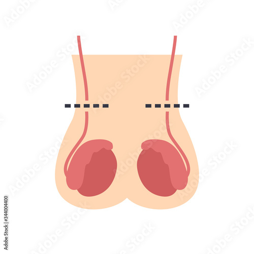 vasectomy flat icon, vector illustration