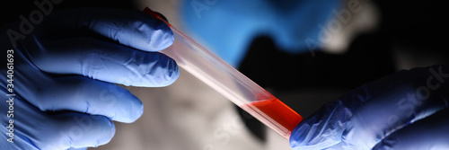 Male chemist examining blood sample in dark laboratory in hospital closeup background. Blood doping test concept