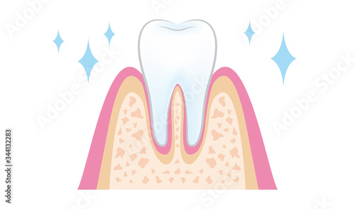 dental_pmtc_step10