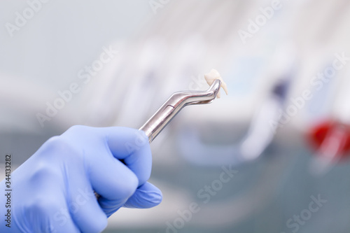 Tooth extraction photo